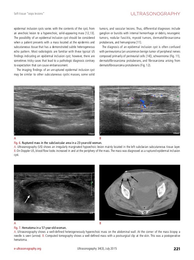 Diagnostic Ultrasound soft tissue