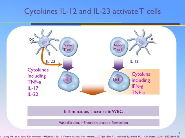 Ustekinumab Therapy Efficacy In Psoriasis Patients Previously Treated