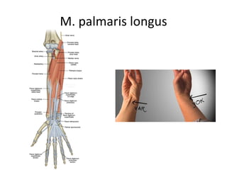 M. palmaris longus
 