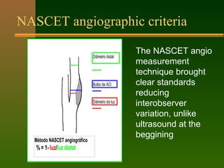 NASCET angiographic criteria
Bulbo de ACI
Diâmetro da luz
Diâmetro distal
Método NASCET angiográfico
%= 1- luz/luz distal
...