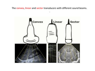 The convex, linear and sector transducers with different sound beams.
.
 