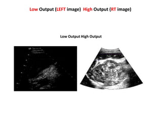 Low Output (LEFT image) High Output (RT image)
Low Output High Output
 