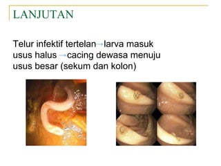 LANJUTAN
Telur infektif tertelan larva masuk
usus halus cacing dewasa menuju
usus besar (sekum dan kolon)
 
