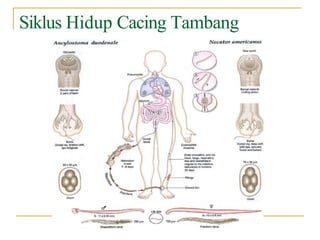 Siklus Hidup Cacing Tambang
 