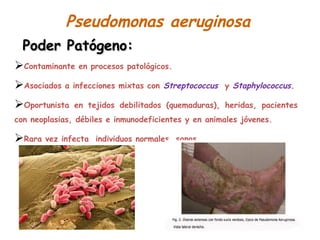 Poder Patógeno:Poder Patógeno:
Contaminante en procesos patológicos.
Asociados a infecciones mixtas con Streptococcus y Staphylococcus.
Oportunista en tejidos debilitados (quemaduras), heridas, pacientes
con neoplasias, débiles e inmunodeficientes y en animales jóvenes.
Rara vez infecta individuos normales, sanos.
Pseudomonas aeruginosa
 