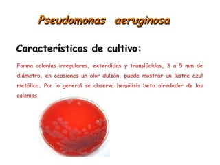 Pseudomonas aeruginosaPseudomonas aeruginosa
Forma colonias irregulares, extendidas y translúcidas, 3 a 5 mm de
diámetro, en ocasiones un olor dulzón, puede mostrar un lustre azul
metálico. Por lo general se observa hemólisis beta alrededor de las
colonias.
Características de cultivo:Características de cultivo:
 