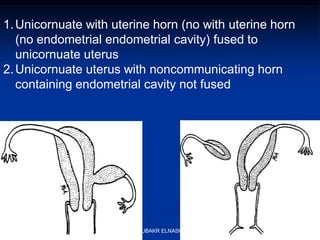 1.Unicornuate with uterine horn (no with uterine horn
(no endometrial endometrial cavity) fused to
unicornuate uterus
2.Unicornuate uterus with noncommunicating horn
containing endometrial cavity not fused
ABOUBAKR ELNASHAR
 