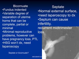 Bicornuate
•Fundus indented
•Variable degree of
separation of uterine
horns that can be
complete, partial or
minimal
•Minimal reproductive
problems, however can
have pregnancy loss, PTL
•HSG won’t dx, need
laparoscopy
Septate
•Normal external surface,
•need laparoscopy to dx
•Septum can cause
infertility,
recurrent midtrimester
loss
Septate or bicornuate?
ABOUBAKR ELNASHAR
 