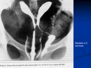 Septate ut 2
cervices
ABOUBAKR ELNASHAR
 
