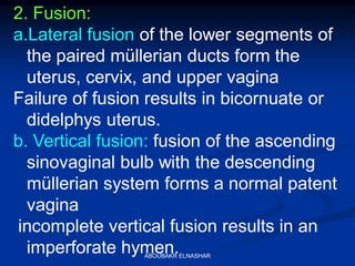 2. Fusion:
a.Lateral fusion of the lower segments of
the paired müllerian ducts form the
uterus, cervix, and upper vagina
Failure of fusion results in bicornuate or
didelphys uterus.
b. Vertical fusion: fusion of the ascending
sinovaginal bulb with the descending
müllerian system forms a normal patent
vagina
incomplete vertical fusion results in an
imperforate hymen.ABOUBAKR ELNASHAR
 