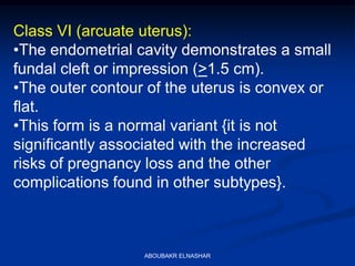 Class VI (arcuate uterus):
•The endometrial cavity demonstrates a small
fundal cleft or impression (>1.5 cm).
•The outer contour of the uterus is convex or
flat.
•This form is a normal variant {it is not
significantly associated with the increased
risks of pregnancy loss and the other
complications found in other subtypes}.
ABOUBAKR ELNASHAR
 