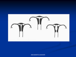 ABOUBAKR ELNASHAR
 