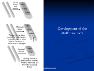 Development of the
Mullerian ducts
ABOUBAKR ELNASHAR
 