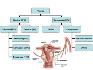 Uterine-Fibroids.ppt