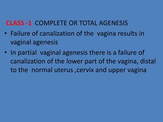 Uterine abnormalities | PPTX