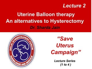 Lecture 2
Uterine Balloon therapy
An alternatives to Hysterectomy
Dr. Sharda Jain

“Save
Uterus
Campaign”
Lecture Series
(1 to 4 )

 