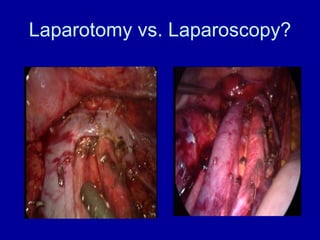 Laparotomy vs. Laparoscopy? 
