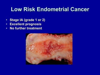 Low Risk Endometrial Cancer Stage IA (grade 1 or 2) Excellent prognosis  No further treatment 