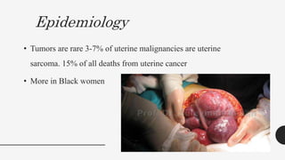 Epidemiology
• Tumors are rare 3-7% of uterine malignancies are uterine
sarcoma. 15% of all deaths from uterine cancer
• More in Black women
 