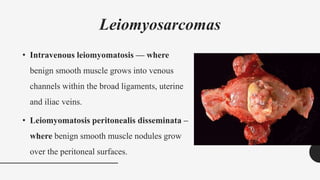 Leiomyosarcomas
• Intravenous leiomyomatosis — where
benign smooth muscle grows into venous
channels within the broad ligaments, uterine
and iliac veins.
• Leiomyomatosis peritonealis disseminata –
where benign smooth muscle nodules grow
over the peritoneal surfaces.
 