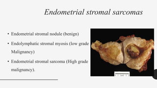 Endometrial stromal sarcomas
• Endometrial stromal nodule (benign)
• Endolymphatic stromal myosis (low grade
Malignancy)
• Endometrial stromal sarcoma (High grade
malignancy).
 