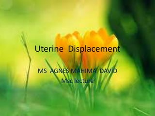 Uterine Displacement
MS AGNES MAHIMA DAVID
Msc lecture
 