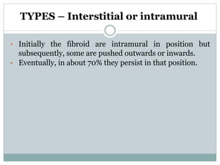 Uterine fibroid | PPTX