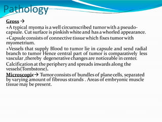 Pathology
Gross 
+A typical myoma is awell circumscribed tumorwith a pseudo-
capsule. Cut surface is pinkish whiteand has awhorled appearance.
+Capsuleconsists of connective tissuewhich fixes tumorwith
myometrium.
+Vessels that supply Blood to tumor lie in capsule and send radial
branch to tumor Hence central part of tumor is comparatively less
vascular ,thereby degenerativechangesare noticeable in center.
Calcificationat the peripheryand spreads inwards along the
vessels(Tombstone).
Microscopic Tumorconsists of bundlesof planecells, separated
by varying amount of fibrous strands . Areas of embryonic muscle
tissue may be present.
 