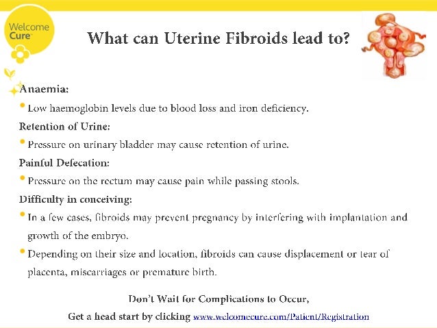 How To Get Rid Of Uterine Fibroids Naturally How To Get Rid Of Uterine Fibroids Naturally