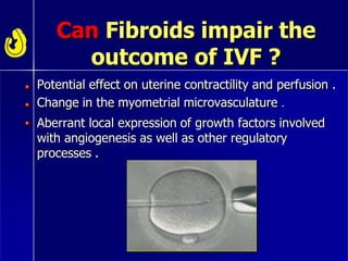 Can Fibroids impair the
outcome of IVF ?
Potential effect on uterine contractility and perfusion .
Change in the myometrial microvasculature .
Aberrant local expression of growth factors involved
with angiogenesis as well as other regulatory
processes .
 