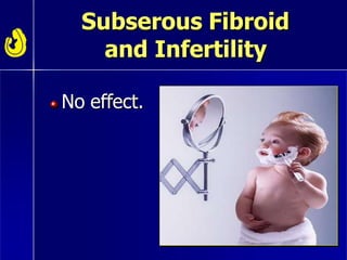 Subserous Fibroid
and Infertility
No effect.
 