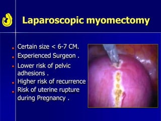 Laparoscopic myomectomy
Certain size < 6-7 CM.
Experienced Surgeon .
Lower risk of pelvic
adhesions .
Higher risk of recurrence
Risk of uterine rupture
during Pregnancy .
 
