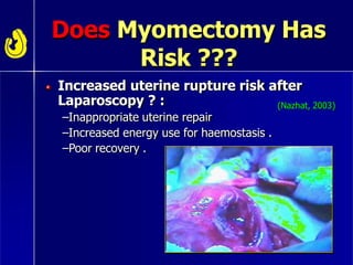 Does Myomectomy Has
Risk ???
Increased uterine rupture risk after
Laparoscopy ? :
–Inappropriate uterine repair
–Increased energy use for haemostasis .
–Poor recovery .
(Nazhat, 2003)
 
