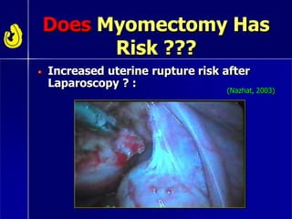 Does Myomectomy Has
Risk ???
Increased uterine rupture risk after
Laparoscopy ? :
(Nazhat, 2003)
 