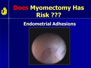 Does Myomectomy Has
Risk ???
Endometrial Adhesions
 