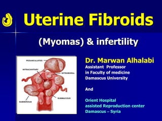 Uterine Fibroids
(Myomas) & infertility
Dr. Marwan Alhalabi
Assistant Professor
in Faculty of medicine
Damascus University
And
Orient Hospital
assisted Reproduction center
Damascus – Syria
 