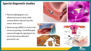 uterine fibroids.pptx