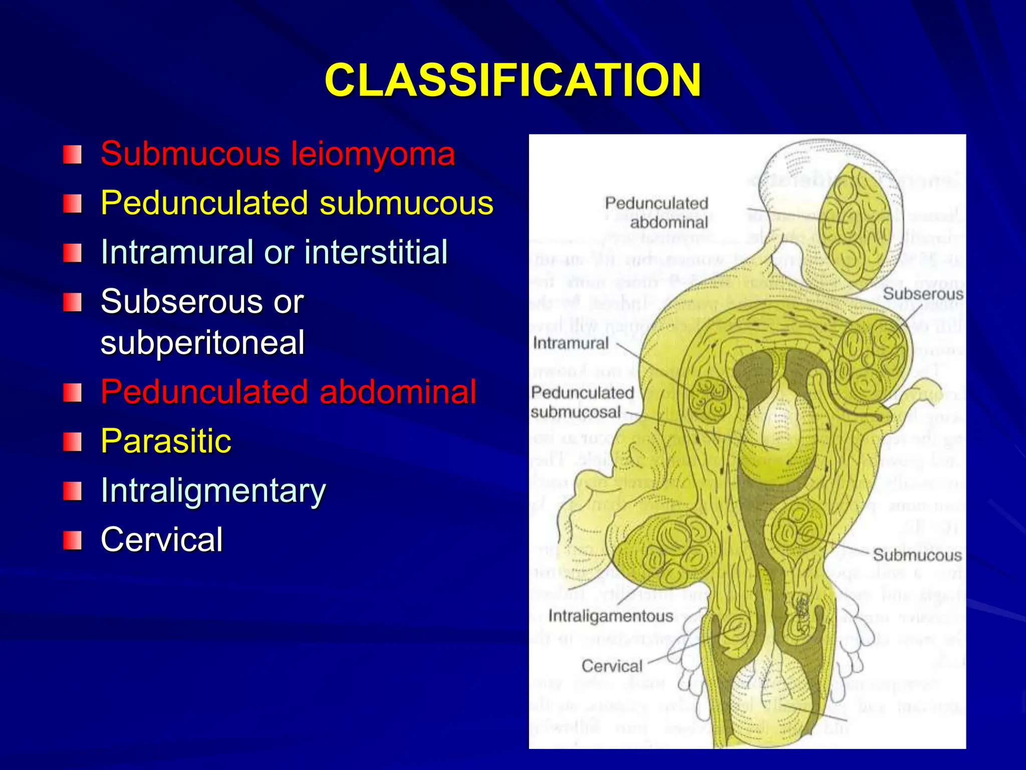 Management of UTERINE FIBROIDS or myoma.pptx