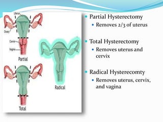  Partial Hysterectomy
 Removes 2/3 of uterus
 Total Hysterectomy
 Removes uterus and
cervix
 Radical Hysterecomty
 Removes uterus, cervix,
and vagina
 