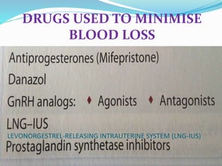 DRUGS USED TO MINIMISE
BLOOD LOSS
LEVONORGESTREL-RELEASING INTRAUTERINE SYSTEM (LNG-IUS)
 