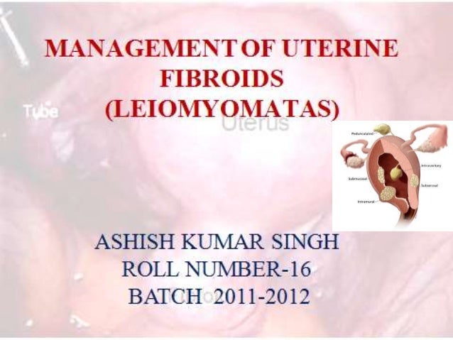 Pathophysiology of uterine fibroids ppt picture