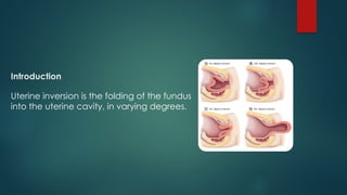 Uterine Inversion.pptx defination, diagnosis | PPTX