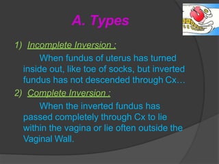 Uterine inversion | PPTX