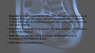 • Class U3 is a bicorporeal uterus with a left and right corpus as a result
of failure of fusion. The outer contour is abnormal with an external
cleft of the fundus. A bicorporeal septate uterus has both an external
cleft and a septum.
• Class U4 is a hemi-uterus as a result of unilateral failure of formation
of the Müllerian duct.
• Class U5 is an aplastic uterus as a result of bilateral failure of
formation of the Müllerian ducts.
• Class U6 are unclassified cases
 
