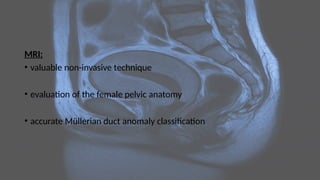 MRI:
• valuable non-invasive technique
• evaluation of the female pelvic anatomy
• accurate Müllerian duct anomaly classification
 
