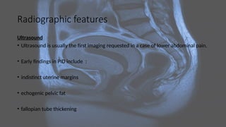 Radiographic features
Ultrasound
• Ultrasound is usually the first imaging requested in a case of lower abdominal pain.
• Early findings in PID include :
• indistinct uterine margins
• echogenic pelvic fat
• fallopian tube thickening
 