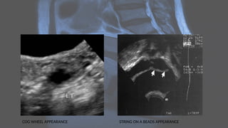 COG WHEEL APPEARANCE STRING ON A BEADS APPEARANCE
 