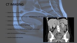 CT IMAGING
• tubular adnexal "mass"
• fallopian tube thickening of >5 mm with enhancing wall: has high specificity of 95%
• indistinct uterine border
• thickening of the uterosacral ligaments
• complex free fluid in the pouch of Douglas (cul-de-sac)
• pelvic fat stranding or haziness
• reactive lymphadenopathy
 