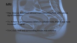 MRI
• May show an ill-defined adnexal mass containing fluid with various
signal intensities:
• T1: if there is proteinaceous debris in a dilated tube, then it may have
increased T1 signal
• T1+C (Gd): wall and surrounding tissues may enhance
 