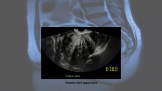 Venetian bird appearance
 